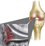image Blood supply for healing only at extreme edge