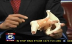 Housecall: Hip Pain in Athletes
